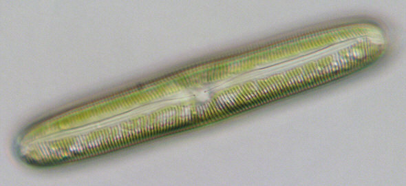 [ Diatomee Triceratium ]